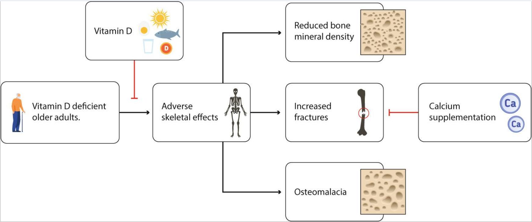 老年人維生素D缺乏對骨骼的影響以及維生素D在預(yù)防中的作用